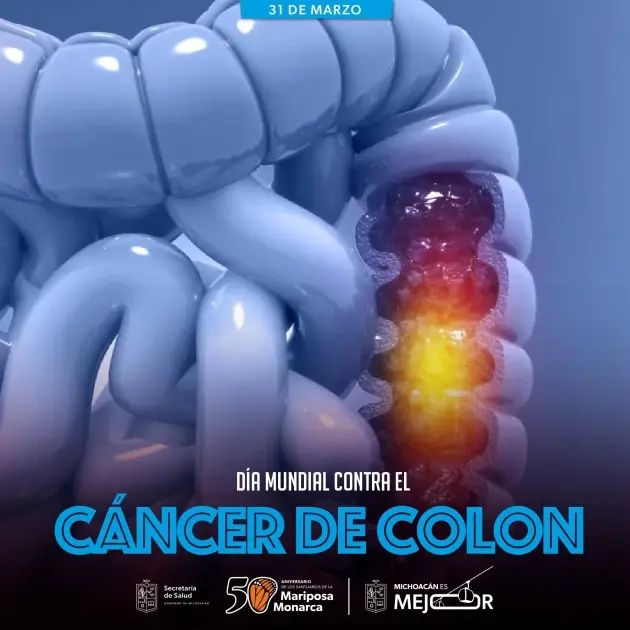 Cáncer de Colon, detectarlo a tiempo es clave para salvar vidas: SSM 