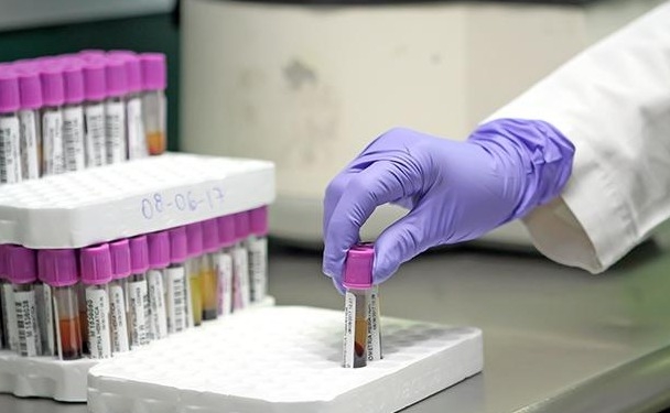 Promueve IMSS Michoacán la detección oportuna de la hemofilia para mejorar calidad de vida  