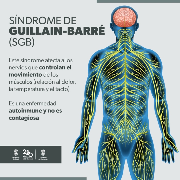 Así se siente el síndrome de Guillain-Barré; puede prevenirse con medidas de higiene 